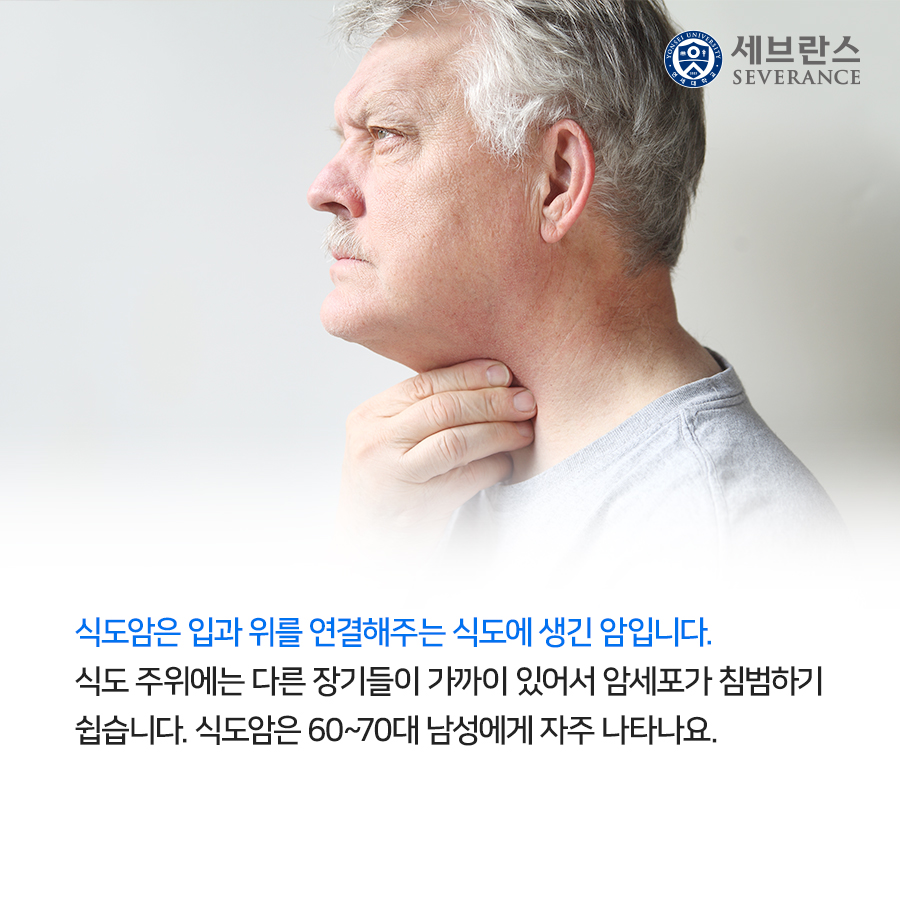 식도암은 입과 위를 연결해주는 식도에 생긴 암입니다. 식도 주위에는 다른 장기들이 가까이 있어서 암세포가 침범하기 쉽습니다. 식도암은 60~70대 남성에게 자주 나타나요.