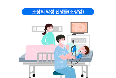 소장암